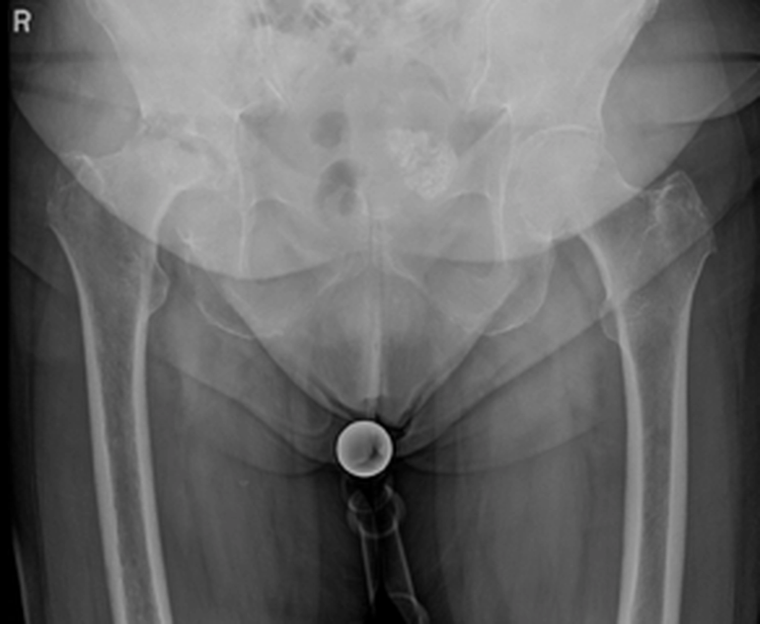 STENUM – Fachklinik für Orthopädie –  Röntgenaufnahme des Hüftgelenks