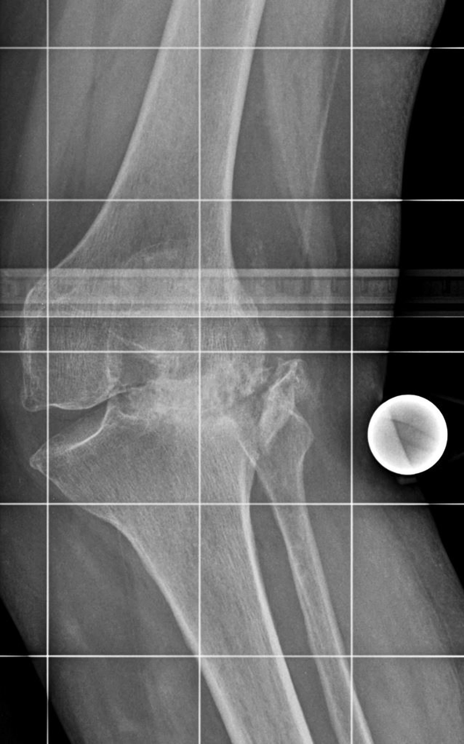 STENUM – Fachklinik für Orthopädie –  Röntgenaufnahme mit Achsengeführt